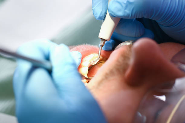 Best 24-Hour Emergency Dental Care in Carson City, MI